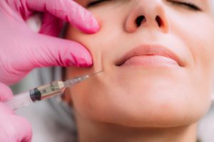 woman getting dermal fillers for her laugh lines