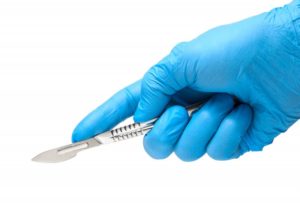 gloved hand holding a scalpel